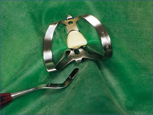 Fit Rubberdam-Látex dique de goma Fit Rubberdam-Látex dique de goma