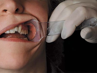 Mirahold retractor de mejillas adulto Mirahold retractor de mejillas adulto