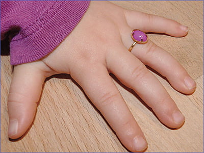 Miratoi Anillos Miratoi Anillos