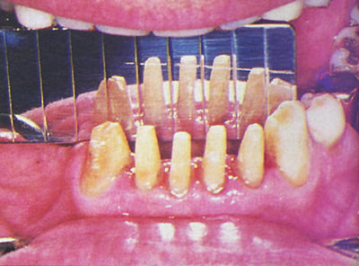 Espejo dental paralelizador Parallelometer-Mirror