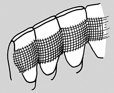 Super Splint Fiber de Luxe