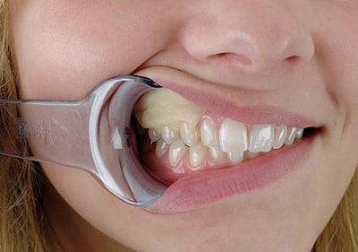 Reso Pac adhesivo periodontal Reso Pac adhesivo periodontal